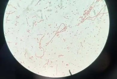 大腸桿菌測序檢測