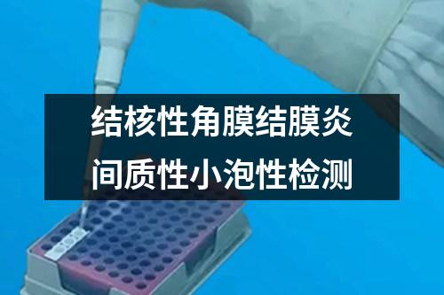 結(jié)核性角膜結(jié)膜炎間質(zhì)性小泡性檢測