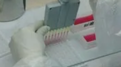 酶聯(lián)免疫測試
